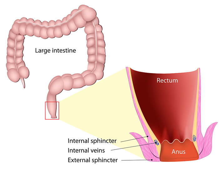 Faecal Incontinence Thesurgeons Pte Ltd